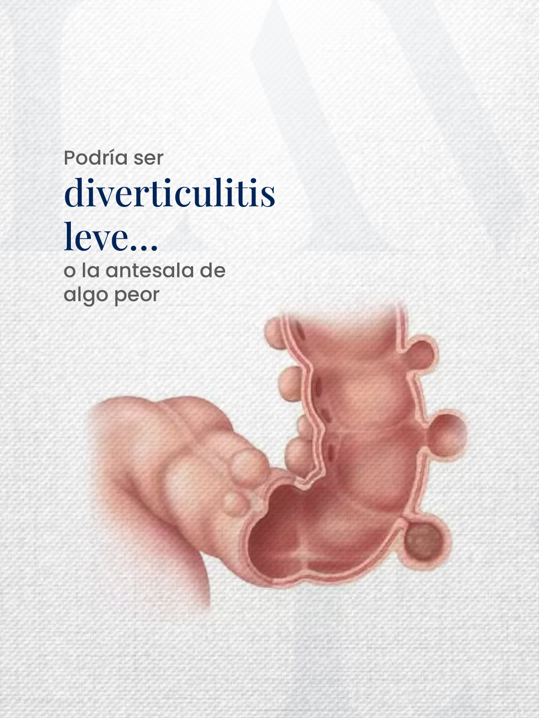 Podría ser diverticulitis leve… o la antesala de algo peor.