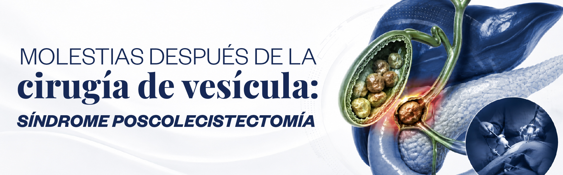 Molestias después de la cirugía de vesícula: síndrome poscolecistectomía