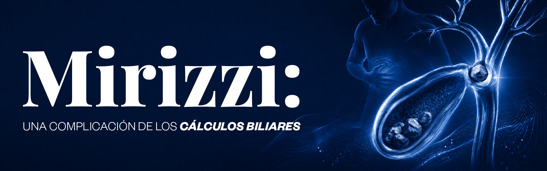 Síndrome de Mirizzi: una complicación de los cálculos biliares