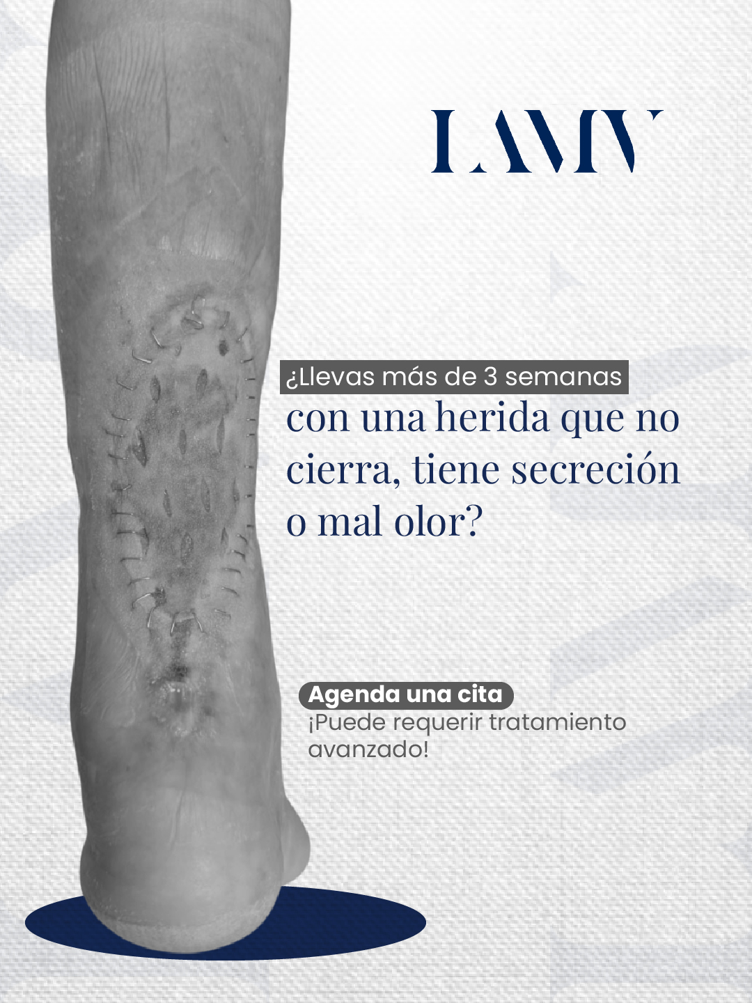 ¿Llevas más de 3 semanas con una herida que no cierra, tiene secreción o mal olor? Puede requerir tratamiento avanzado.