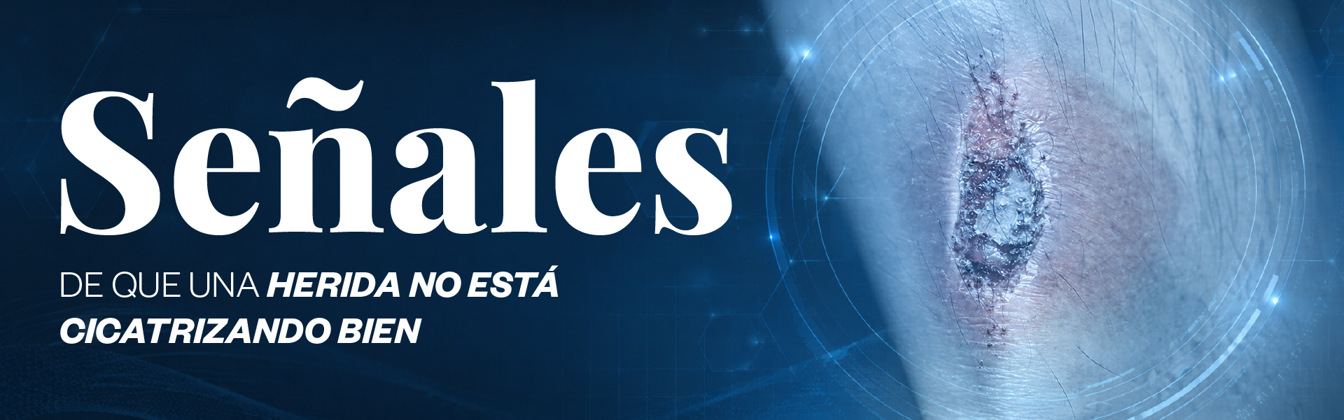 Señales de que una herida no está cicatrizando bien