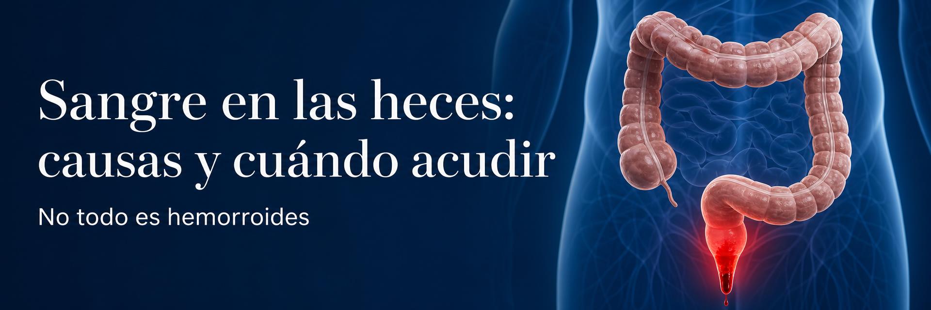 Sangre en las heces: causas y cuándo acudir