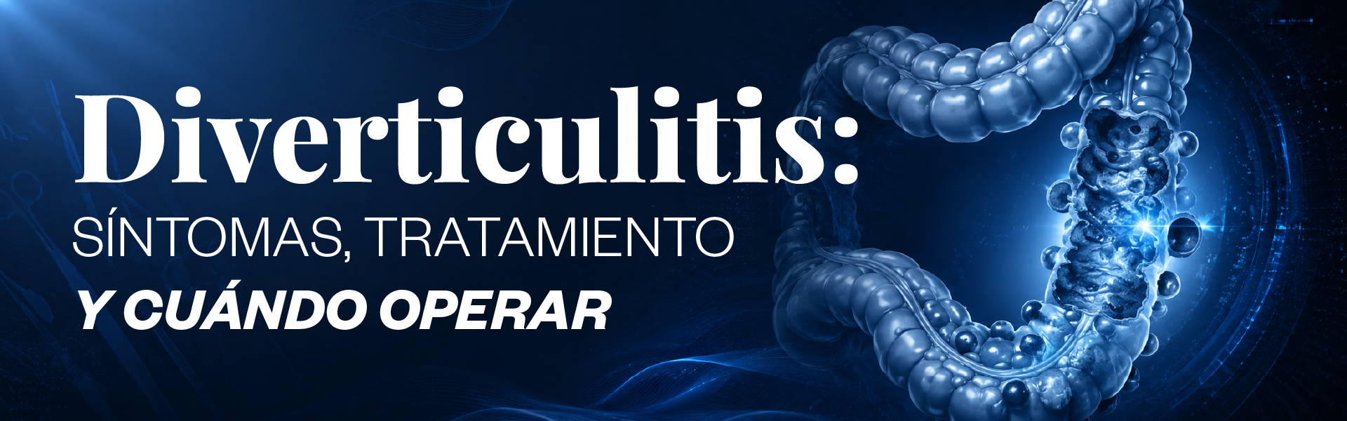 Diverticulitis: síntomas, tratamiento y cuándo operar