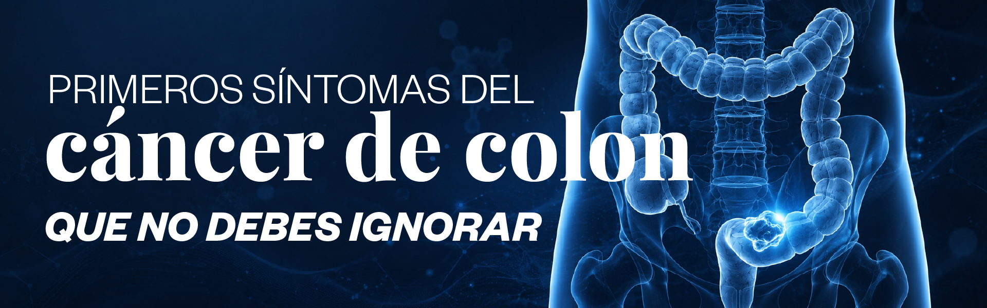 Primeros síntomas del cáncer de colon que no debes ignorar