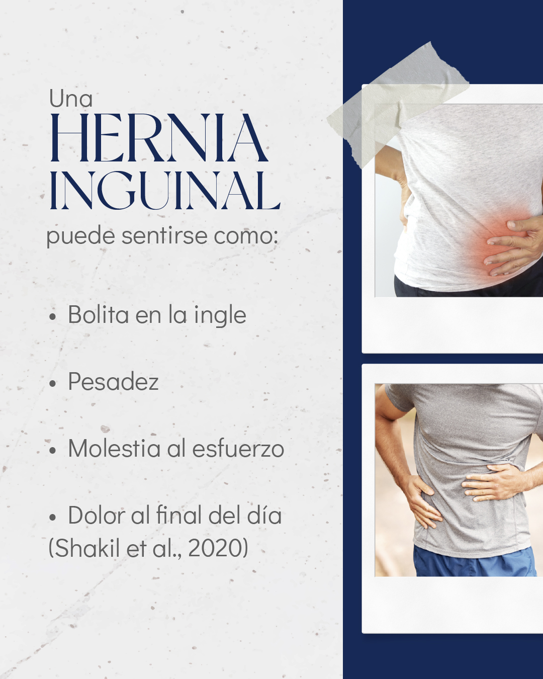 Una hernia inguinal puede sentirse como bolita en la ingle, pesadez, molestia al esfuerzo o dolor al final del día.